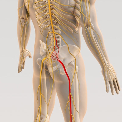 Can a Chiropractor Fix a Pinched Nerve?