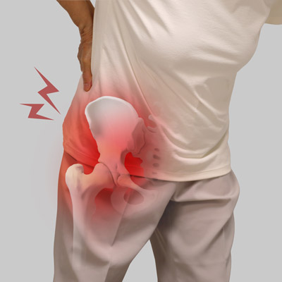 Can a Chiropractor Help with Hip Pain?